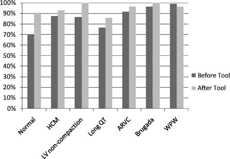 Accuracy of ECG interpretation by diagnosis.