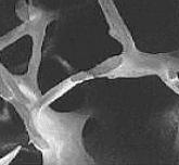 Progenitor osteoklasta Prekurzor osteoklasta osteoklasti Resorpcija kostiju steoblast