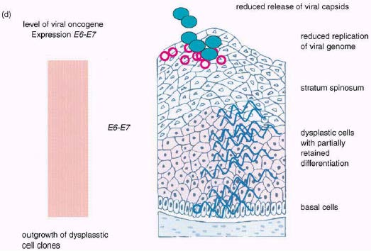 HPV μόλυνση (κακό σενάριο) Doeberitz M.