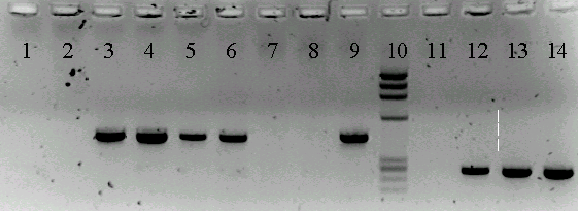 A1. Ανίχνευση DNA HPV: In house Consensus PCR ΜΥ consensus primers MY, GP+, SPF10 etc (L1
