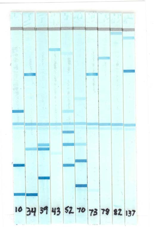 LINEAR ARRAY Genotyping test (Roche) Τυποποίηση 37 HR+LR τύπων (PGMY-PCR + reverse line blot)