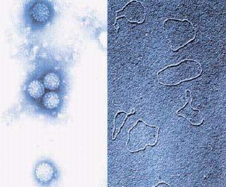 HPV (Human Papilloma Virus) Ιός ανθρώπινων Θηλωμάτων 55 nm Golf ball 20εδρικό καψίδιο (72 καψομερίδια) + ~8 Kb δίκλωνο κυκλικό