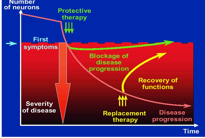 Πάρο αυτά όμως μέχρι σήμερα δεν έχει βρεθεί νευροπροστατευτική θεραπεία ώστε να ανακόψει την εξέλιξη της νόσου. Εικόνα 6.