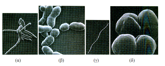 Κεφάλαιο 3 Αναερόβια Επεξεργασία Micrococcus M. candidus Toerien (1967a) Neisseria N. catarhhalis McCarty et al. (1962) Pseudomonas P. denitrificants Burbank et al. (1966) Sarcina S.