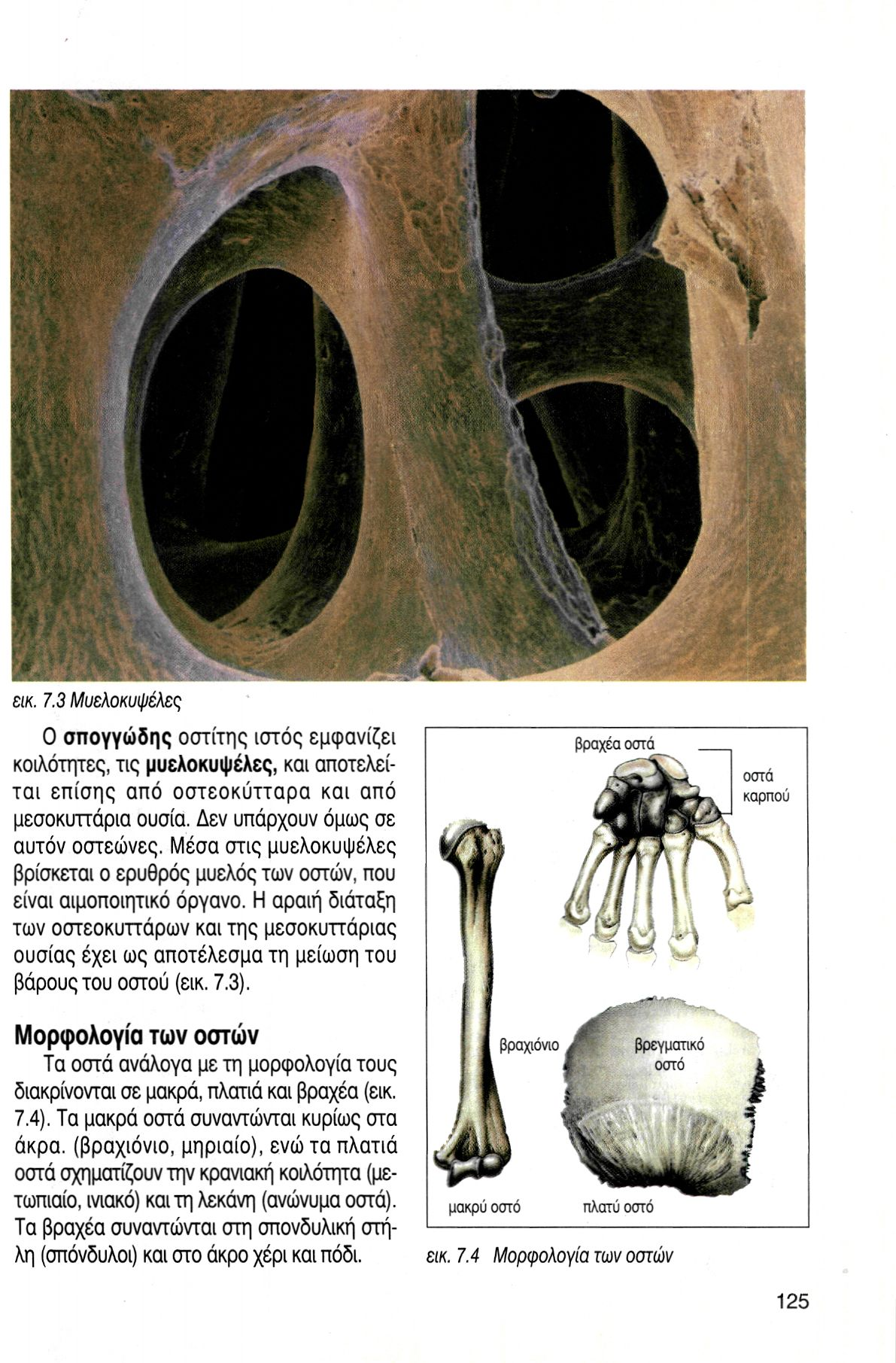 εικ. 7.3 Μυελοκυψέλες Ο σπογγώδης οστίτης ιστός εμφανίζει κοιλότητες, τις μυελοκυψέλες, και αποτελείται επίσης από οστεοκύτταρα και από μεσοκυττάρια ουσία. Δεν υπάρχουν όμως σε αυτόν οστεώνες.