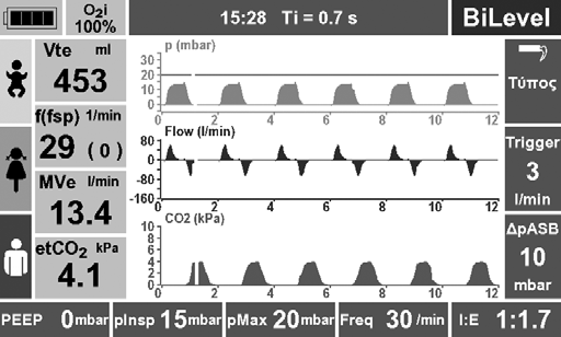Προβαλλόμενες τιμές μέτρησης Κατά τη διάρκεια της μηχανικής αναπνοής προβάλλονται στην οθόνη οι εξής παράμετροι ως αριθμητικές τιμές: O 2 i: Μετρούμενη από τη συσκευή συγκέντρωση O 2 Vt e :