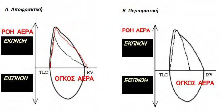 3.2.2 Μορφολογικές καμπύλες ροής όγκου για πνευμονικές παθήσεις αποφρακτικού και περιοριστικού τύπου Γνωρίζοντας την αναμενόμενη εμφάνισης καμπύλης ροής όγκου ενός ασυμπτωματικού ασθενή, μπορούν να