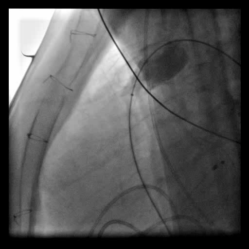 Παρουσίαση περιστατικού (1) RVOT-