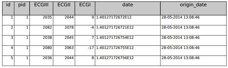 Table structure for table original_ecgs Column Type Null Default id int(11) No pid int(11) No