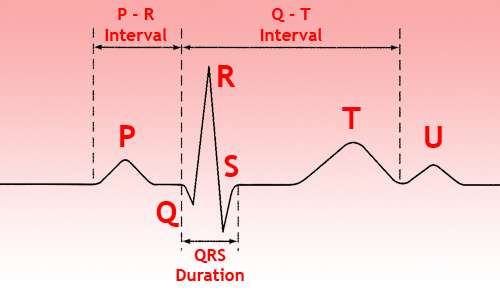 2.2.3 Ηλεκτροκαρδιογράφημα ΗΚΓ (ECG) Για την ηλεκτρική περιγραφή της καρδιακής δραστηριότητας είναι δυνατό να θεωρηθεί, ότι σε κάθε στιγμή της ακολουθίας της κοιλιακής δραστηριότητας η ηλεκτρική