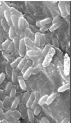 Κατευθύνσεις της έρευνας Βιο-λιπάσματα (Bio fertilizers) Λιπάσματα με μικροοργανισμούς Όχι Μεταλλαγμένοι μικροοργανισμοί Στο λίπασμα γίνεται ανάμιξη σπορίων μικροοργανισμών Αυτoί