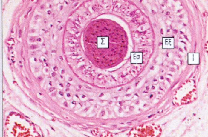 Εγκάρσια τοµή τριχοθυλακίου πάνω από το βολβό Το στέλεχοςτης τρίχας (Σ) περιέχει υπολείµµατα πυρήνων και είναι έντονα οξεόφιλο.