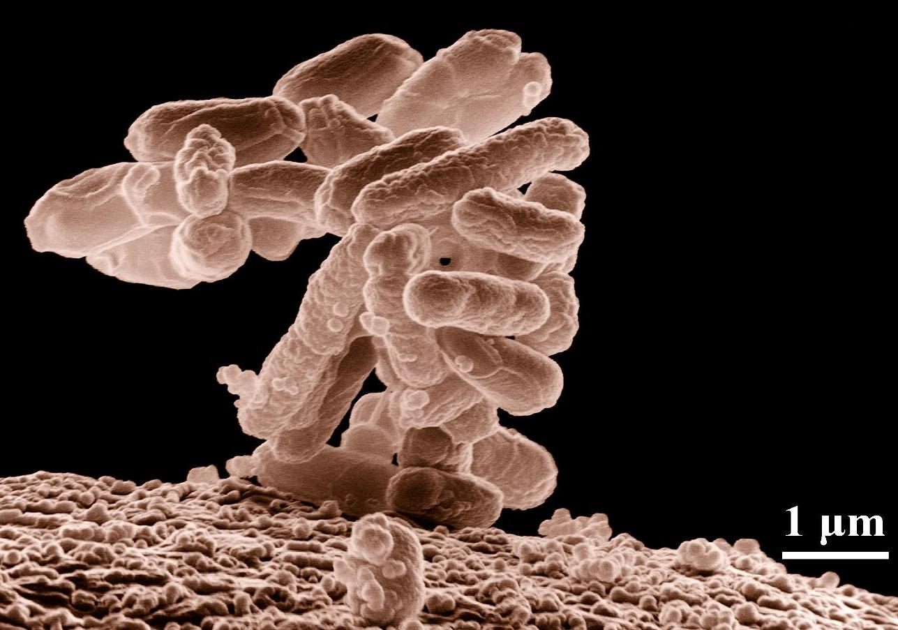 Τυπική αποικία Escherichia coli Πηγή: http://www.