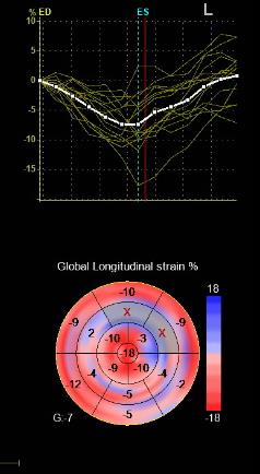 3D-STRAIN