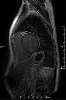 Fig. 4a Fig.4b 3c Fig.