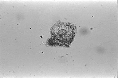 Amoeba proteus (Leidy,