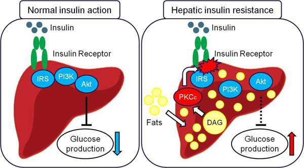 Tipovi rezistencije na insulin Periferna Mišići smanjen ulazak glukoze u ćelije posredstvom GLUT4; smanjena sinteza glikogena Masno tkivo -povećana lipoliza; smanjen
