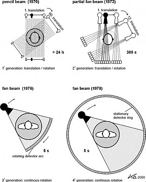 slice spiral CT-MSCT). Στα προαναφερθέντα συστήματα Υ.Τ ο αριθμός των σειρών και το μέγεθος (εύρος) των ανιχνευτών διαφέρει από σύστημα σε σύστημα (Figure 2).