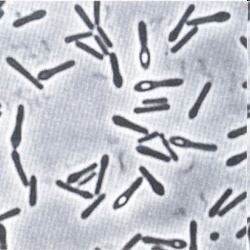 Familia β-lactamine Cefalosporine Generaţia I - Cefalexin, Cefalotin, Cefazolin - Spectru îngust - E.