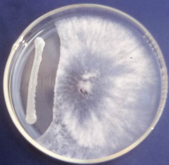 Antibioterapia origini: antibioza şi toxicitatea selectivă.