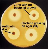 Antibiograma prin metoda difuzimetrică Interpretarea rezultatelor Cu o rigla se masoara diametrul zonei de inhibitie a dezvoltarii