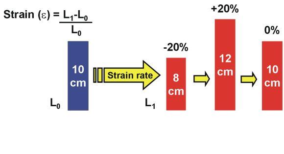 ΙΣΤΙΚΗ ΠΑΡΑΜΟΡΦΩΣΗ (STRAIN -S) Παραμόρφωση (%) μεταβολή στο μέγεθος ενός τμήματος του μυοκαρδιακού ιστού μεταξύ δύο χρονικών σημείων.