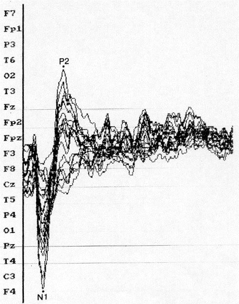 ρήκα 3.9: Ν100 θαη Ρ200 3.6.