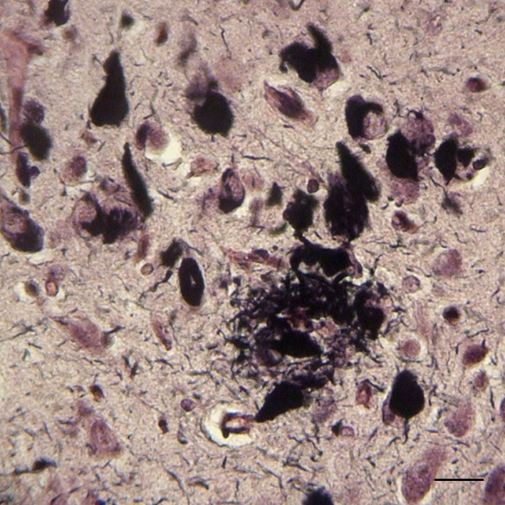 Α Β Εικόνα 10. Α) Νευρικές ίνες στην κεφαλή του κερκοφόρου πυρήνα υγιούς µάρτυρα µε τη µέθοδο Nauta. Κλίµακα 20µm.