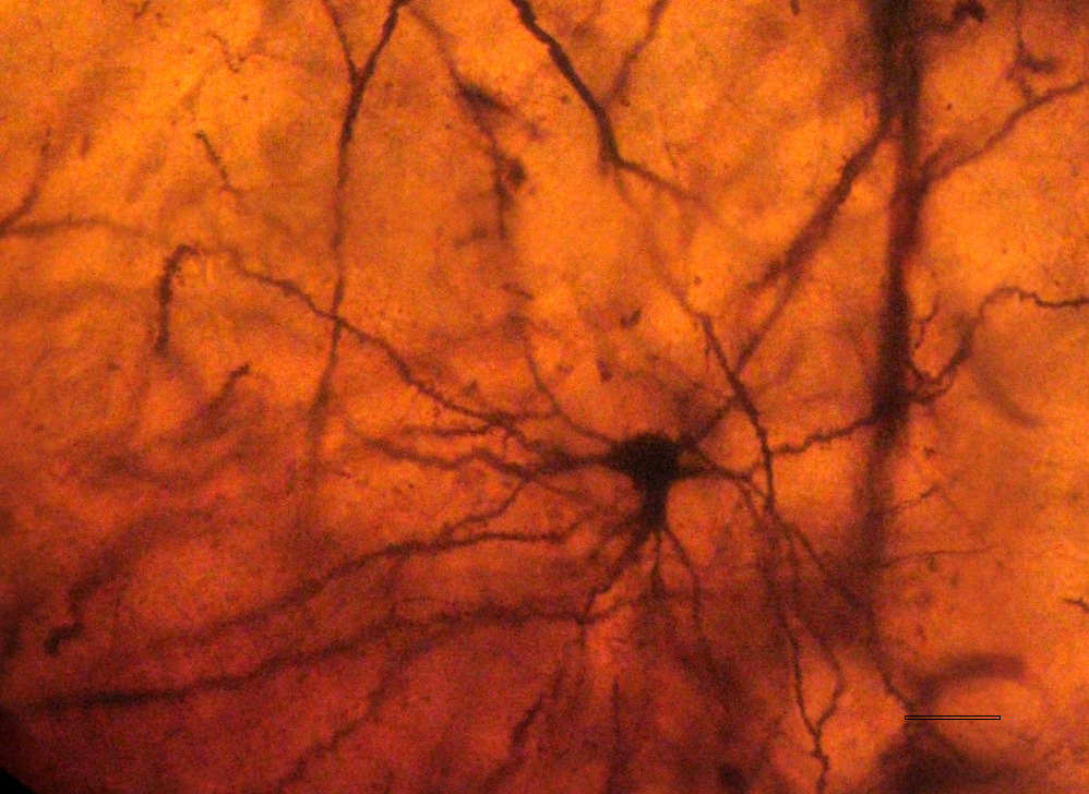 Εικόνα 13. Μεγάλου µεγέθους νευρώνας κερκοφόρου πυρήνα µε λείους δενδρίτες.