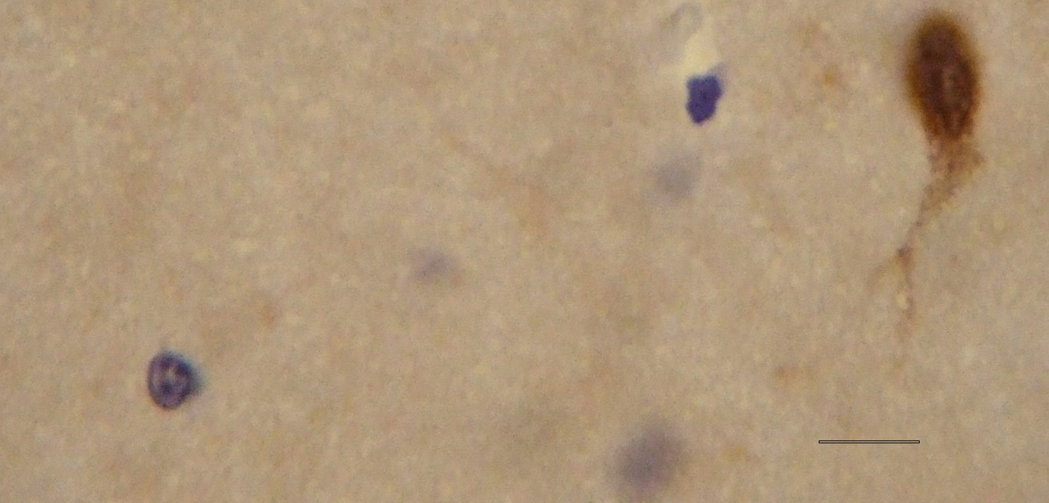 A B Εικόνα 24. Α) Μεγάλου µεγέθους νευρώνας κερκοφόρου πυρήνα έντονα ανοσοθετικός για mglur5 τόσο στο κυτταρικό σώµα όσο και σε τµήµα δενδρίτη.