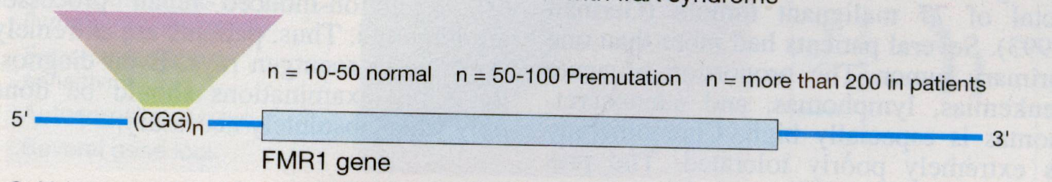 ΣΥΝ ΡΟΜΟ ΕΥΘΡΑΥΣΤΟΥ Χ Αριθμός τριπλετών Ητριπλέτα CGG βρίσκεται στο 5 άκρο του γονιδίου FMR1 και υφίσταται μεθυλίωση στην κυτοσίνη (C) με αποτέλεσμα την μη έκφραση του