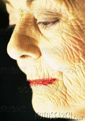 2.5 ΡΥΤΙ ΕΣ Οι ρυτίδες αποτελούν το πιο χαρακτηριστικό γνώρισµα του γηρασµένου και ιδιαίτερα του φωτογηρασµένου δέρµατος.