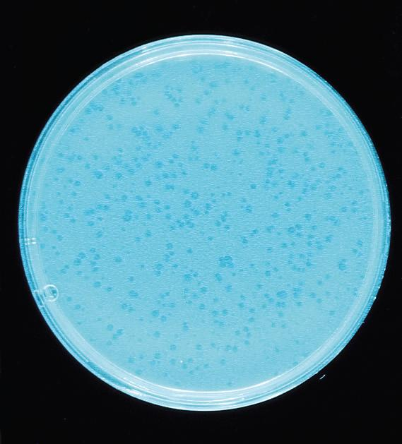 ΕΙΚΟΝΑ 1.44 Πλάκες βακτηριοφάγου. Διακρίνονται πλάκες του βακτηριοφάγου Τ4 πάνω σε χλόη από E. coli.