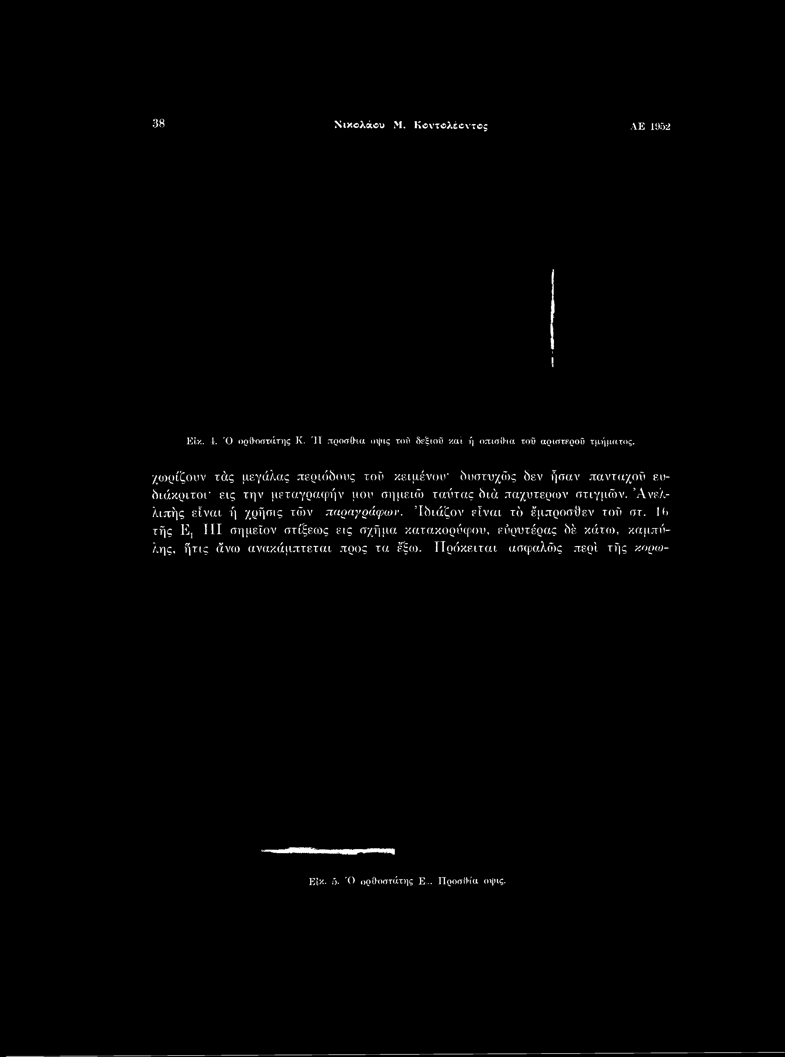 38 Νικολάου Μ. Κοντολέοντβς ΑΕ 1952 Είκ. 4. Ό ορθοστάτης Κ. Ή πρόσθια οψις τού δεξιού καί ή οπίσθια τοΰ αριστερού τμήματος.