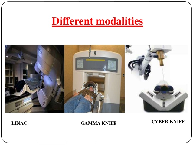 SRT modalities Gamma knife