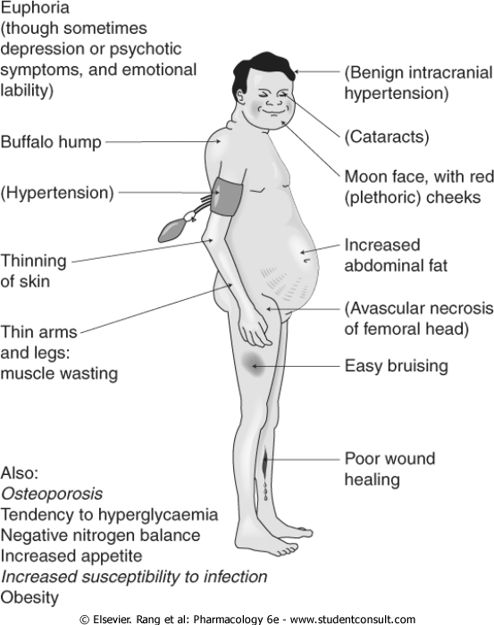 Osteoporoza Česta, teška komplikacija Zavisi od doze i dužine terapije (kumulativna doza), a javlja se u svim starosnim dobima Smatra se da će 30-50% pacijenata koji su na hroničnoj terapiji