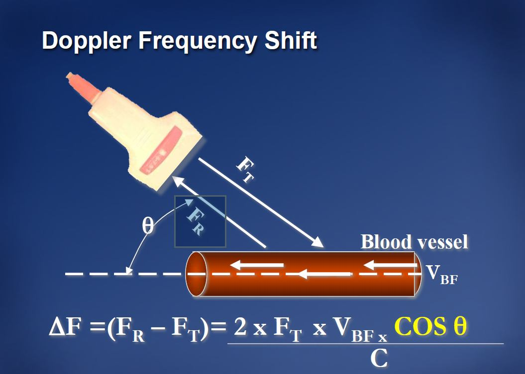 Η συμβατική B-mode (brightness mode) υπερηχογραφία Τα σήματα υπερήχων που αντανακλώνται από στατικές επιφάνειες έχουν την ίδια συχνότητα με την οποία εκπέμφθηκαν Τα σήματα που ανακλώνται από