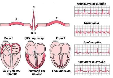 Ηλεκτροκαρδιογράφημα (ΗΚΓ) Στο ηλεκτροκαρδιογράφημα καταγράφονται τα κύματα P, QRS και T.