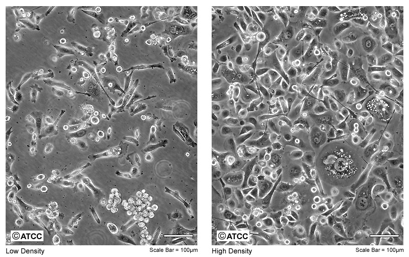 Εικόνα 2.1 Καλλιέργεια επιθηλιακών καρκινικών κυττάρων παχέος εντέρου ΗΤ29. Αριστερά: χαμηλή πυκνότητα. Δεξιά: υψηλή πυκνότητα. Κλίμακα 100μm. Εικόνα 2.