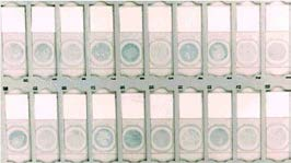 ΑΠΑΙΤΟΥΜΕΝΑ ΥΛΙΚΑ CytoLyt. Διάλυμα PreservCyt.