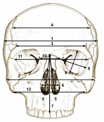 Εικόνα 7.4 Κρανιακές διαστάσεις πρόσθια όψη. 13. Μέγιστο μήκος κρανίου (maximum cranial length - GOL, M1). 14.