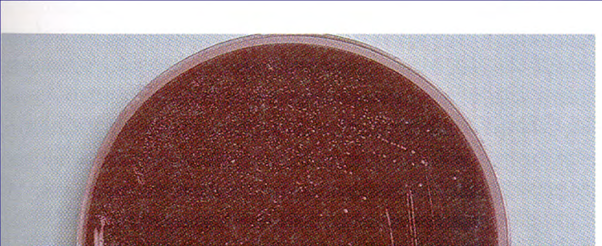 Καλλιέργεια Campylobacter