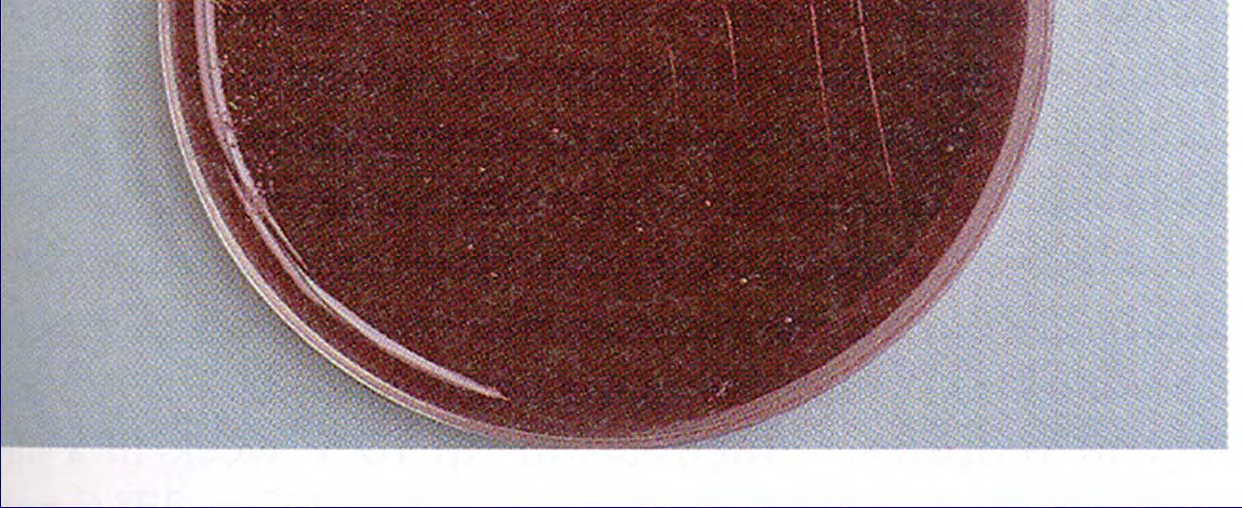 (except sputorum) ID by above,