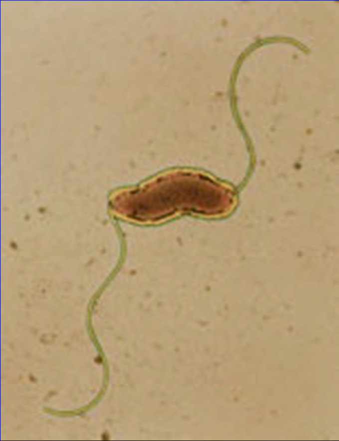 Τι είναι το Campylobacter jejuni?