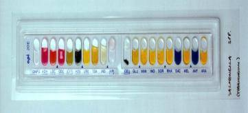 (& σε outbreaks) Για έλεγχο καθαρότητας