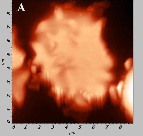 Εικ. 14: Α: Εχινοκφτταρο όπωσ φαίνεται με τθ χριςθ ΜΑΔ. Β: Ρροεκβολζσ του εχινοκυττάρου τθσ εικόνασ 14Α.