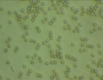 16: Φωτογραφίεσ από οπτικό μικροςκόπιο για διαφορετικζσ αραιϊςεισ του αιματοκρίτθ (μl ολικοφ αίματοσ /μl πλάςματοσ ).