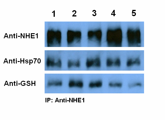 δεν φάνηκε να επηρεάζει τη σύνδεση της Hsp70 στον ΝΗΕ1, αύξησε όμως τα επίπεδα γλουταθειονυλίωσης των μορίων Hsp70 που ήταν ήδη συνδεδεμένα με τον ΝΗΕ1 (εικόνα 1, σύγκριση στηλών 1 και 2).