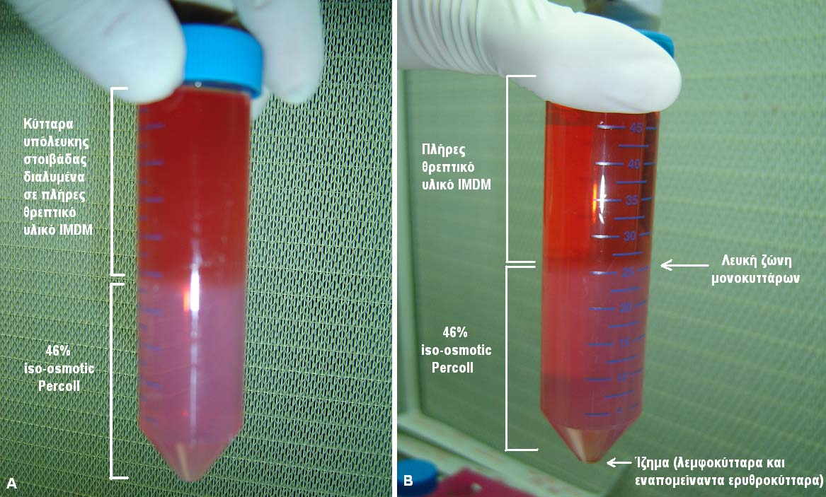 osmotic Percoll στα δύο δοχεία falcon των 50 ml γινόταν επιστοίβαξη με 25 ml διαλύματος κυττάρων (δηλαδή με ίζημα που ήταν διαλυμένο σε πλήρες θρεπτικό υλικό IMDM) και στη συνέχεια πραγματοποιούνταν