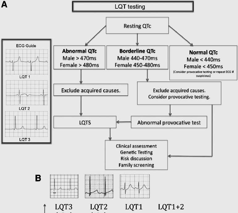 Προτεινόμενος αλγόριθμος διερεύνησης LQT Syndrome